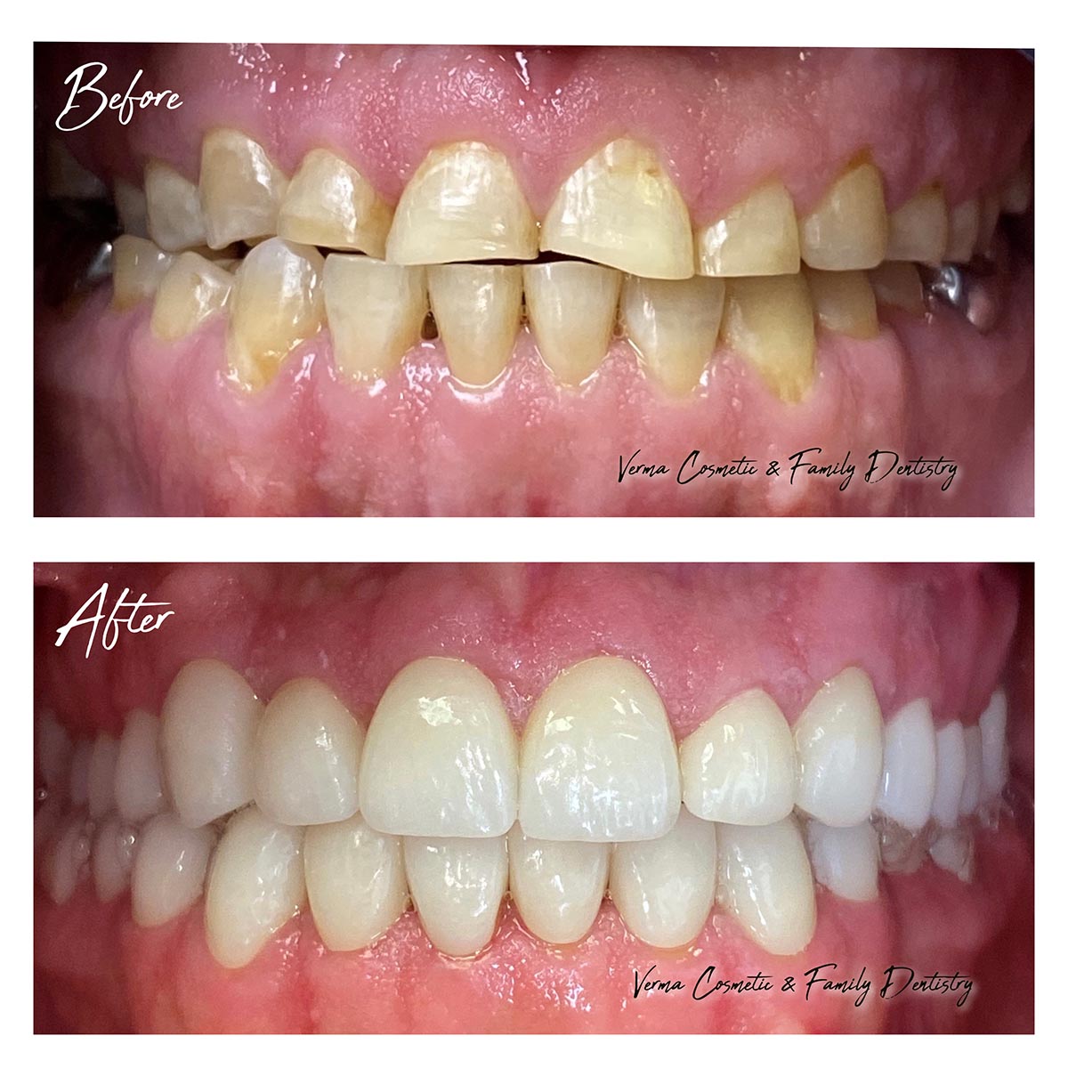dr-verma-before-after (1)