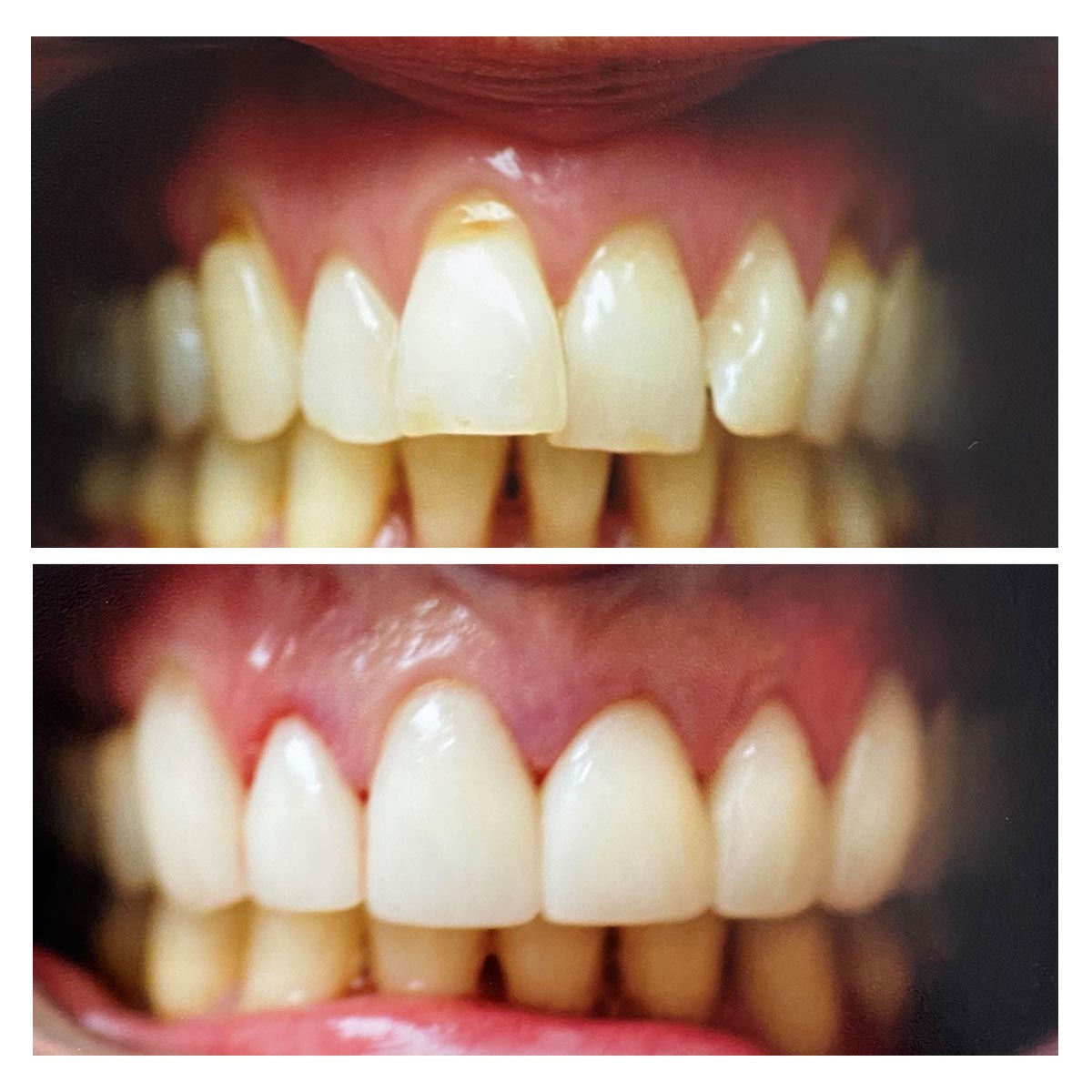 dr-verma-before-after (2)