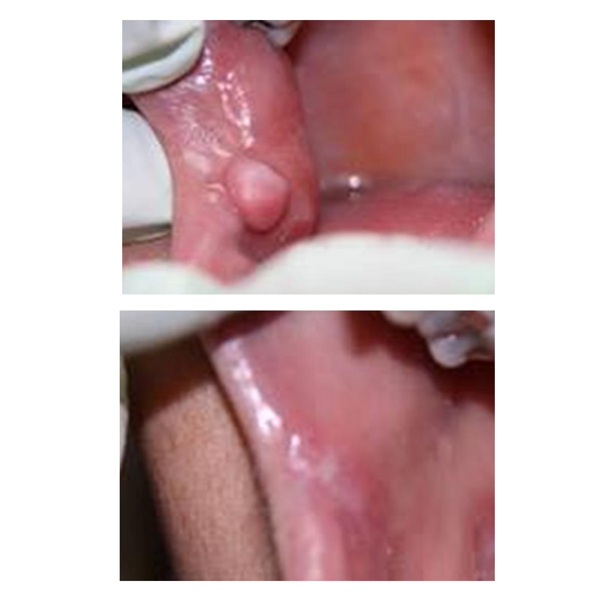 dr-verma-before-after (6)