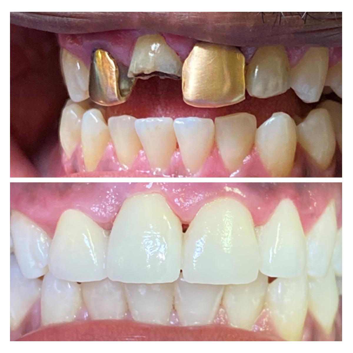 dr-verma-before-after (8)